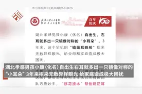 罕见！3岁幼儿长出第三只耳，医生“移花接木”帮矫正耳廓畸形图片