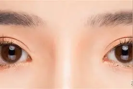 眼睛痒有血丝，说一个方子，养阴、活血还祛风，改善眼睛干涩红痒图片