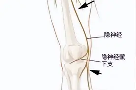 膝关节内侧痛，有可能是这根神经出现问题图片