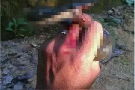 每年80000人被蛇咬死！蛇这么危险，为什么不能让蛇完全灭绝？图片