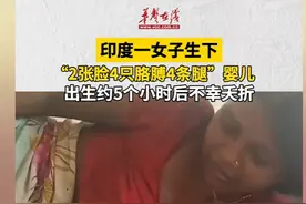 惊呆了，印度女子生下2张脸4只胳膊婴儿，评论区都震惊了图片