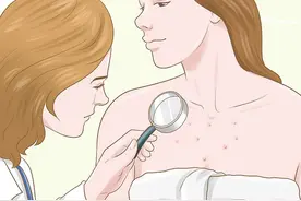 前胸后背总长痘，可能感染了这种“真菌”图片