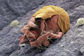 小孩被大量寄生虫掏空健康，医生：这些食物不能乱吃，危害很大！图片