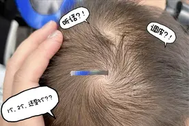 头顶有“2个旋”的孩子，真的更聪明、脾气更倔吗？看完涨知识图片