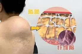 富贵包里是什么东西？怎么消除？图片