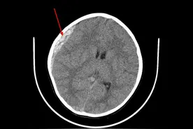 揪心！杭州市儿童医院接诊多个电瓶车带娃事故 家长务必守好安全关！图片