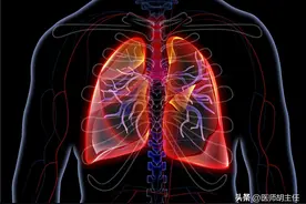 “肺纹理增多”，是一种什么病？会不会很严重？医生详解图片