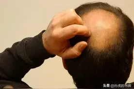 官方曝光的“毒洗发水”，很多家庭还在用，难怪现在头发越来越少图片