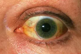 眼睛干涩，浑浊，视物不清，一个中成药，给眼睛洗洗澡，恢复明亮图片