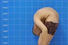 “折叠人”李华：为活命骨头被敲断4次，植入22颗钢钉，现状如何图片