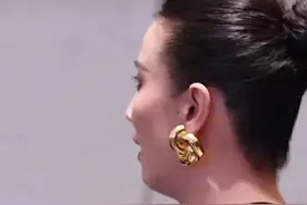 43岁宋佳近照！腋下妇乳明显，真空礼服险走光，胳膊上痕迹引热议图片