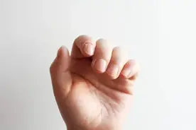 甲沟炎会自己好吗？ 多久会好？ 要看哪一科？图片