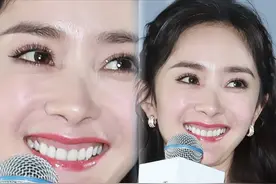 烤瓷牙对女明星的伤害有多大？陈瑶整牙致变脸认不出图片