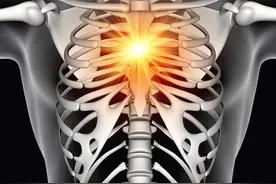 突发胸痛，不一定是心绞痛或心肌梗死！肋软骨炎一定要知道！图片