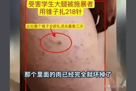 山东女生被同桌狠扎218针，同桌家底被曝，官方：未达霸凌标准图片