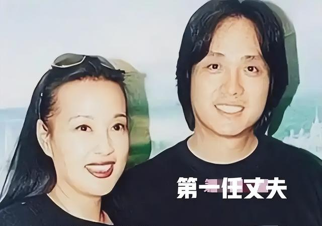 钱再多有什么用75岁刘晓庆摔断左臂,拒绝休养只因无儿无女