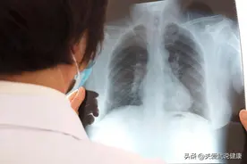 56岁的右肺中叶8mm肺结节，庆幸坚持做了手术，手术后就没事了图片