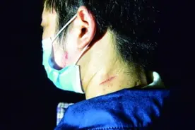 2016年八达岭老虎咬人案：母亲虎口救女儿身亡，女儿毁容无工作图片