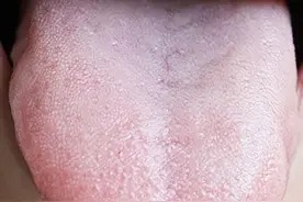 出汗越多，气越虚！分享一个止汗方，无论自汗、盗汗都能调图片