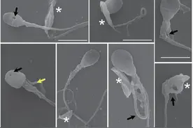 5分钟就能“斩首”人类精子，这种藏在猫砂中的寄生虫可能已感染全球一半人口图片
