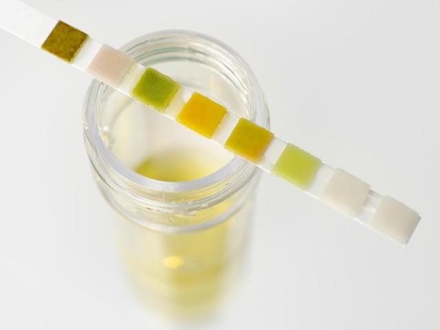 49岁男子尿毒症去世，医生心酸：把3样当饭吃，肾脏再好也扛不住