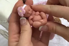 现实版“拇指姑娘”：出生时仅25CM，十几年过去了，现状如何？图片