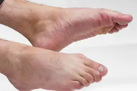 血虚“头”先知，气虚“脚”先知？如何养血补气，还看这6招！图片