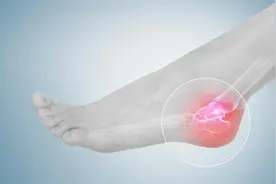 足跟痛怎么办？医生：使用这4个方式，或能使症状有所改善图片