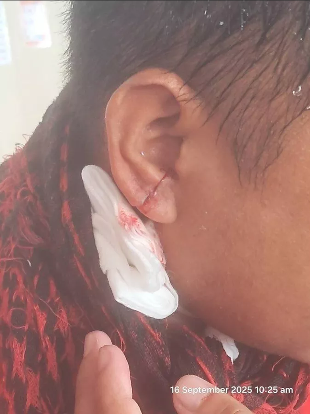 菲船故意撞击中国海警船	，被水炮打碎窗户有人受伤，摇白旗投降