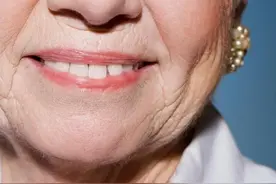 脸上长出这种皱纹，警惕心梗要来！别以为只是年纪上来了图片