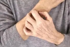 身上经常痒，却没有什么东西？医生：或暗示这4个问题，别大意了图片