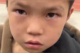 后续！广西熊孩子抓蛇带到学校，本以为是悲剧，看到他经历惊呆了图片