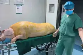 山东8岁女孩患怪病，为活命只能与猪“合体”，监控拍下揪心一幕图片