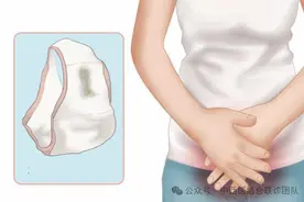 HPV发展速度有多快？身体出现4个异常表现，说明病情已进入危险期图片