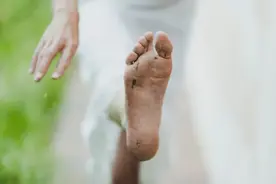 3个实用方法，快速根治脚气不复发图片