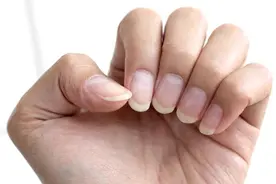 指甲月牙小、有竖纹，就是不健康？错！这些真相一定要知道图片