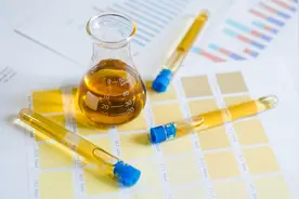 做尿液检查，如何正确留尿？图片