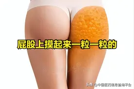 屁股上摸起来一粒一粒的图片