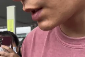 内娱皮肤最差的演员-丁禹兮图片