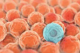 癌症患者的希望：抗癌疗法新突破，不开刀30分钟内就能消灭肿瘤图片