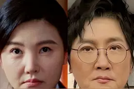 医美的尽头是孙楠？杨子珊新剧疑动脸像孙楠，网友：这脸还有戏演图片
