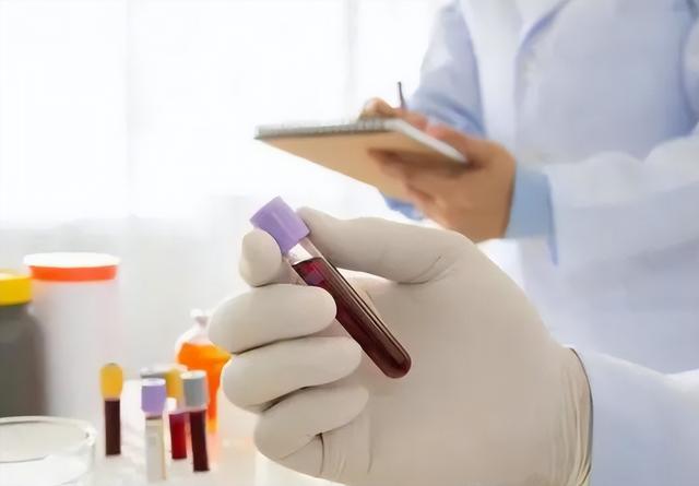 63岁女子皮肤瘙痒，以为是皮肤病，体检后，医生叹：怎么不早来