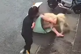 “救命鼻子掉了！”江苏女子带孩子摸狗被撕咬面部，后续画面曝光图片