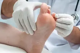 长期脚上有脚气的人，一般都逃不过这五大原因，看看你都知道吗？图片