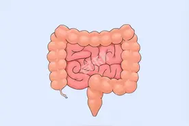 肠癌是个“傻子癌”，提醒：身体有这4种症状，请尽早检查图片
