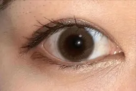 体内有癌，眼睛先知？提醒：眼睛若有这5种迹象，最好检查一下！图片