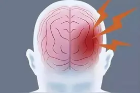 腔梗到底是个什么病，危险不？出现这5个症状，及时就医！图片
