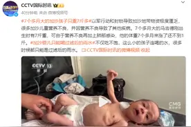 7个多月大的加沙孩子只重7斤多图片
