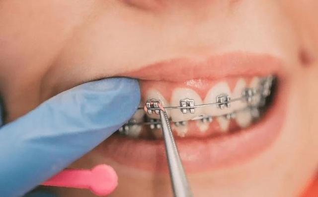 暴跌60%，引发全国牙科关店潮，曾经暴利的牙科生意要凉透了？