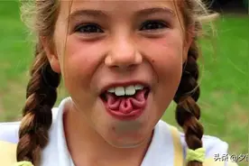 10种罕见的人体特征，拥有一个或是“天选之人”，看你占了几种？图片